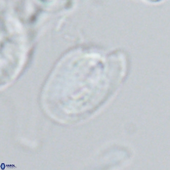 Helicosphaera epimikeisporous VR 04617