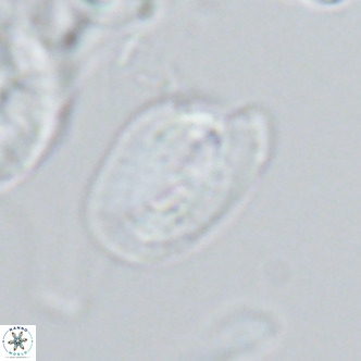 Helicosphaera epimikeisporous VR 04617