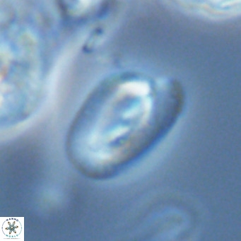 Helicosphaera epimikeisporous VR 04620