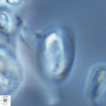 Helicosphaera epimikeisporous VR 04621