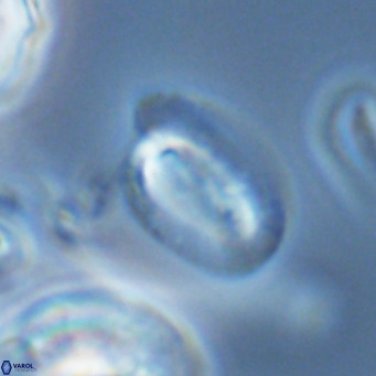 Helicosphaera epimikeisporous VR 04622