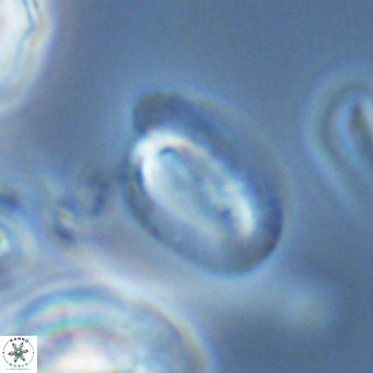 Helicosphaera epimikeisporous VR 04622