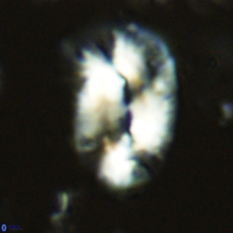 Helicosphaera epimikeisporous VR 05140