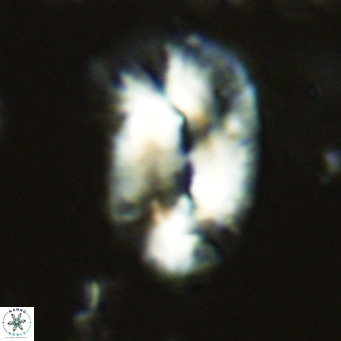 Helicosphaera epimikeisporous VR 05140