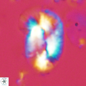 Helicosphaera epimikeisporous VR 05141