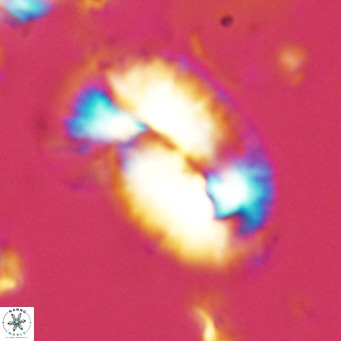 Helicosphaera epimikeisporous VR 05142