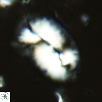 Helicosphaera epimikeisporous VR 05143