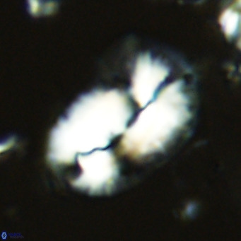 Helicosphaera epimikeisporous VR 05144