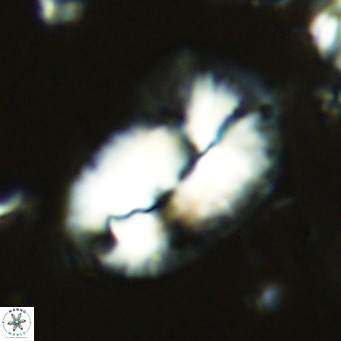 Helicosphaera epimikeisporous VR 05144