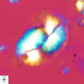 Helicosphaera epimikeisporous VR 05145