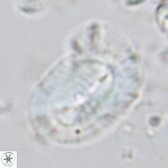 Helicosphaera epimikeisporous VR 05146