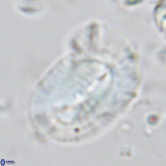 Helicosphaera epimikeisporous VR 05364