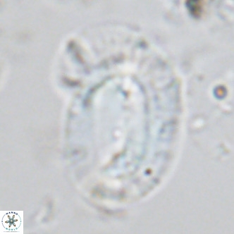 Helicosphaera epimikeisporous VR 05147