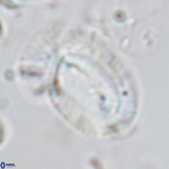 Helicosphaera epimikeisporous VR 05148