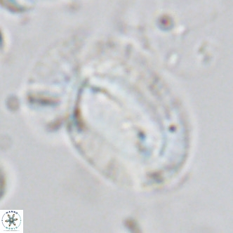 Helicosphaera epimikeisporous VR 05148