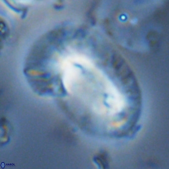 Helicosphaera epimikeisporous VR 05149