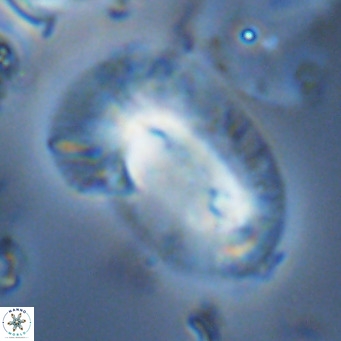Helicosphaera epimikeisporous VR 05149