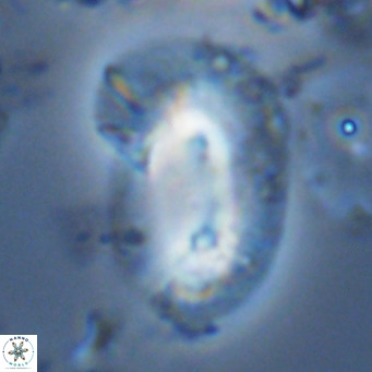 Helicosphaera epimikeisporous VR 05150