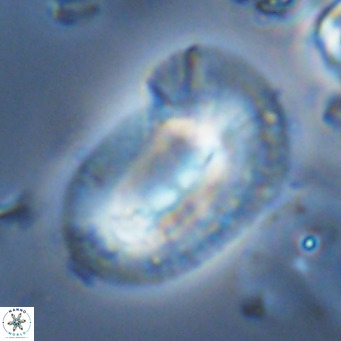 Helicosphaera epimikeisporous VR 05151