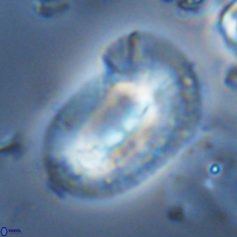Helicosphaera epimikeisporous VR 05364