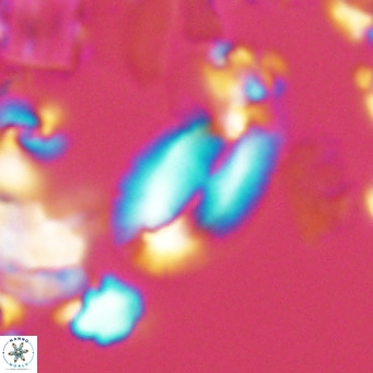 Helicosphaera epimikeisporous VR 05365