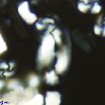 Helicosphaera epimikeisporous VR 05367