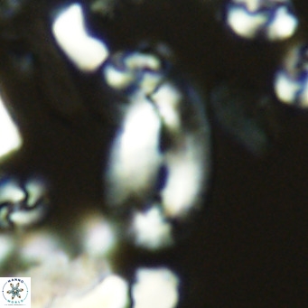 Helicosphaera epimikeisporous VR 05367