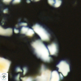 Helicosphaera epimikeisporous VR 05368