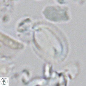 Helicosphaera epimikeisporous VR 05370