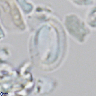 Helicosphaera epimikeisporous VR 05372