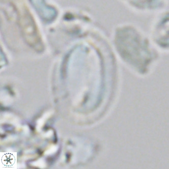 Helicosphaera epimikeisporous VR 05372