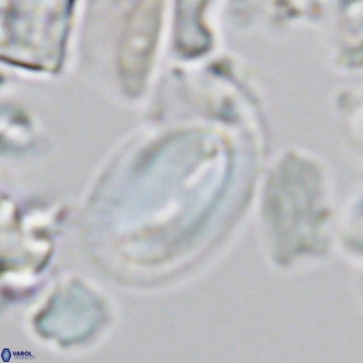 Helicosphaera epimikeisporous VR 05373