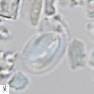 Helicosphaera epimikeisporous VR 05373