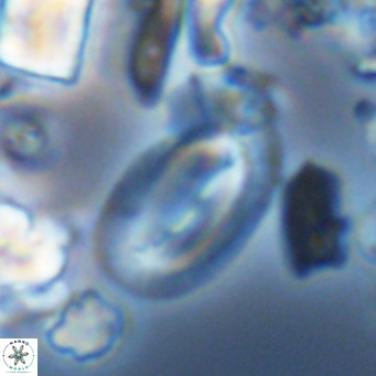 Helicosphaera epimikeisporous VR 05374