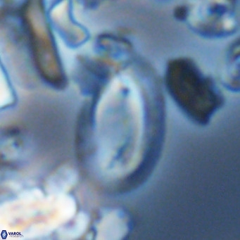 Helicosphaera epimikeisporous VR 05375