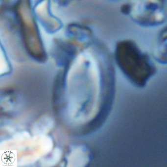 Helicosphaera epimikeisporous VR 05375