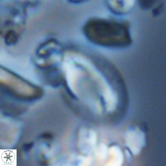 Helicosphaera epimikeisporous VR 05376
