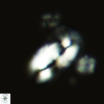 Helicosphaera epimikeisporous VR 06041