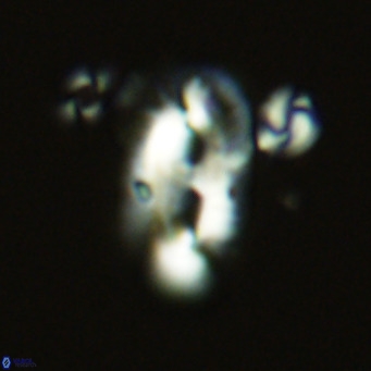 Helicosphaera epimikeisporous VR 06044