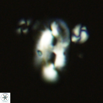 Helicosphaera epimikeisporous VR 06044