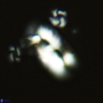 Helicosphaera epimikeisporous VR 06047