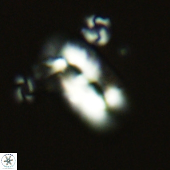 Helicosphaera epimikeisporous VR 06047
