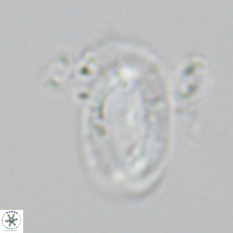Helicosphaera epimikeisporous VR 06050