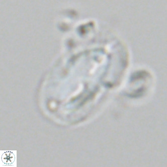 Helicosphaera epimikeisporous VR 06055