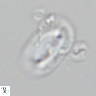 Helicosphaera epimikeisporous VR 06056