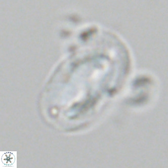 Helicosphaera epimikeisporous VR 06057