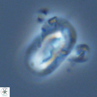 Helicosphaera epimikeisporous VR 06058