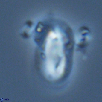 Helicosphaera epimikeisporous VR 06059