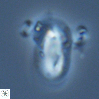 Helicosphaera epimikeisporous VR 06059