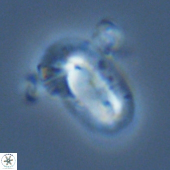 Helicosphaera epimikeisporous VR 06060